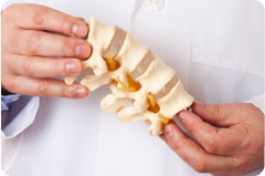 artrose osteoporose