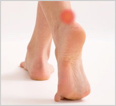 Achillespees blessure. Voorkomen en Behandelen