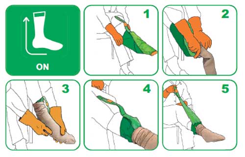 Magnide On Off | aantrekhulp & uittrekhulp | gesloten teen