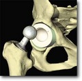 orthopedie orthopedie