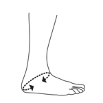 Push Care enkelbrace Maat Push Care enkelbrace Maat