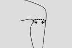 Push Care kniebrace Maat Push Care kniebrace Maat